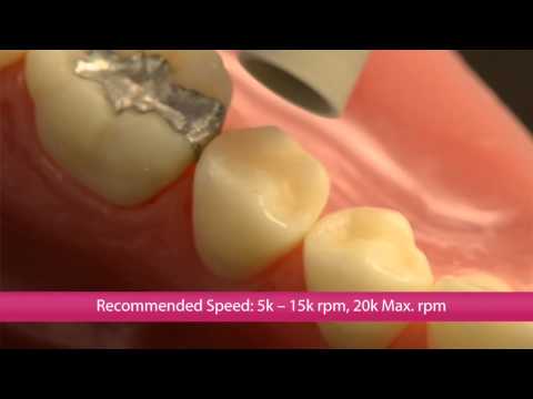 CompoMaster and CompoMaster Coarse (Shofu)