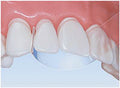 Mylar Strips